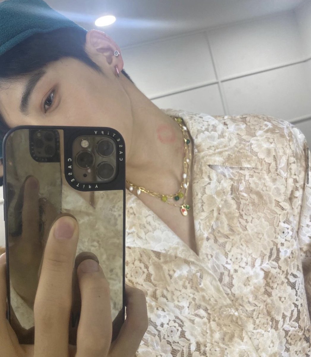 do you guys remember when eunwoo posted this photo and people on instagram started asking him who gave him the kiss mark 😭
