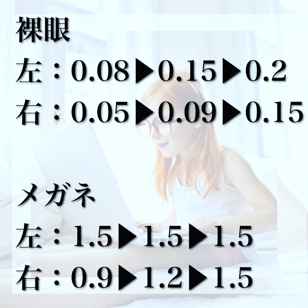 lovewingnail's tweet photo. 嘘みたいなホントの話。小学校高学年から視力が落ちて、ずっと視力0.1以下・PC仕事で目を酷使している私が、たった30分×2回の施術で0.2と0.15に✨
目のトレーニング銀座店さん、すごすぎる✨
https://t.co/TEaXh3FIpJ

@meno_training_

→ https://t.co/8gnkGodbAf