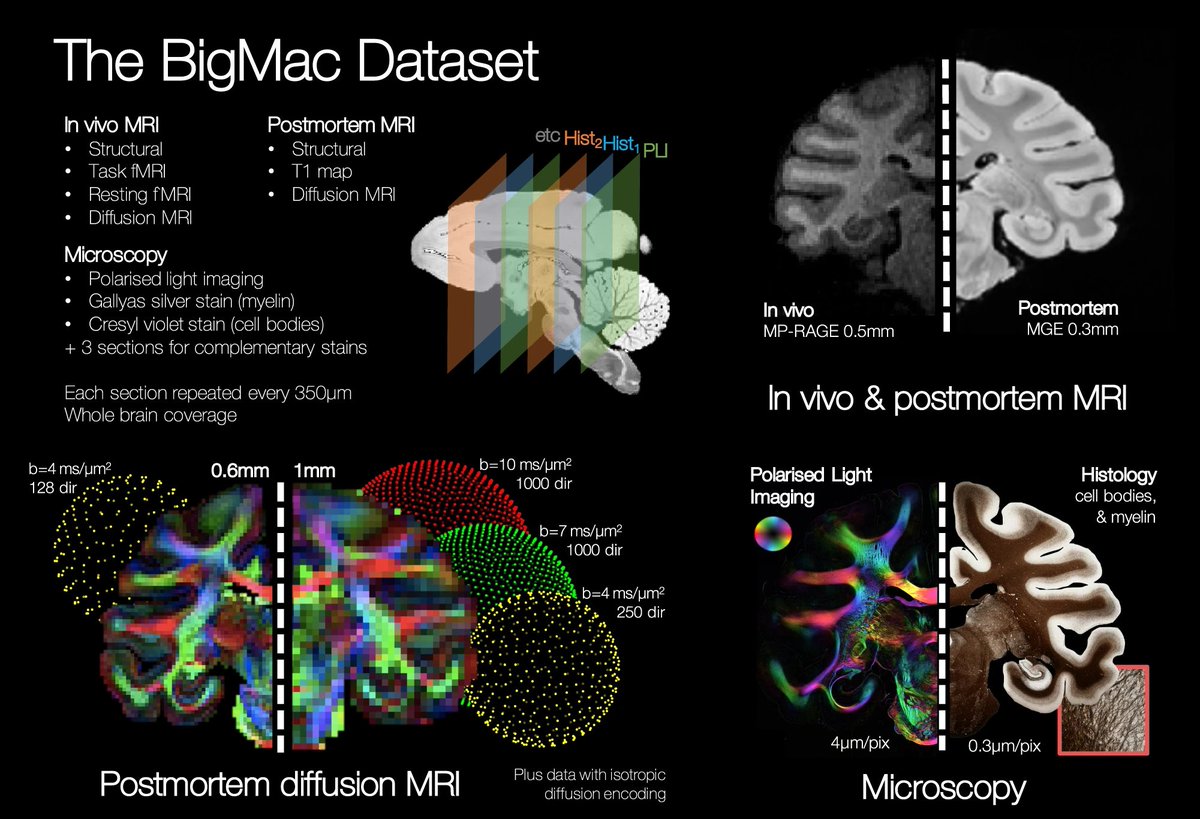 thmonk_pf's tweet photo. 【The BigMac Dataset】

Macaqueの脳MRIを主体としたOpen data

In vivo MRI
Postmortem MRI
Microscopy

Open Access

#MRI 
#open_data 
#papers 
https://t.co/dEfhMpax4Y https://t.co/cmcTq6C2GN