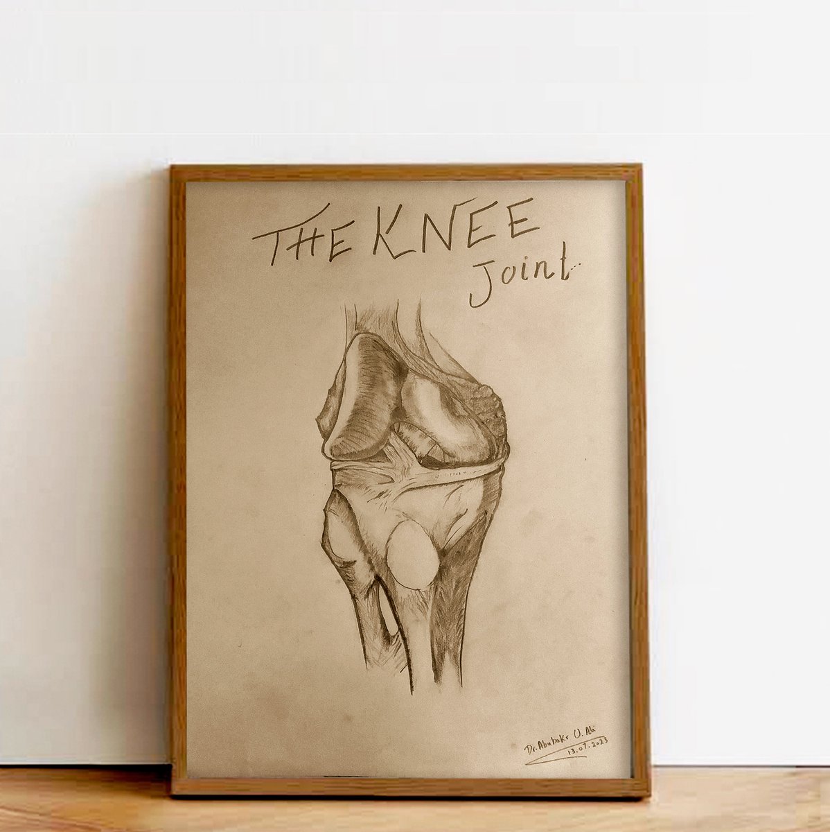 BKoOR_'s tweet photo. Do what you love and love what you do #orthopedics Rt knee https://t.co/ED9GQpS8lu