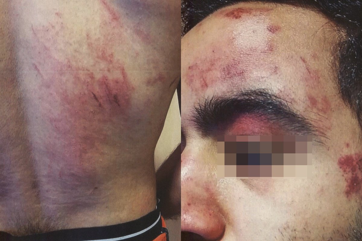 Este ultraderechista se llama Santiago Contreras y fue coordinador de VOX en Gavà. Hoy ha sido condenado a prisión por dar una paliza a un joven brasileño al grito de "negro y maricón de mierda". Es íntimo amigo de Garriga, líder de VOX en Catalunya.