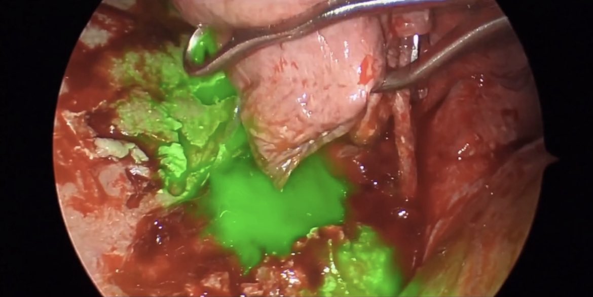 Justin A. Olivera, MD tweet media