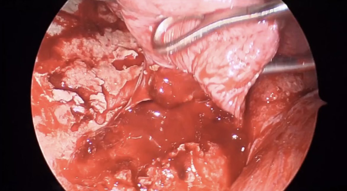 Justin A. Olivera, MD tweet media