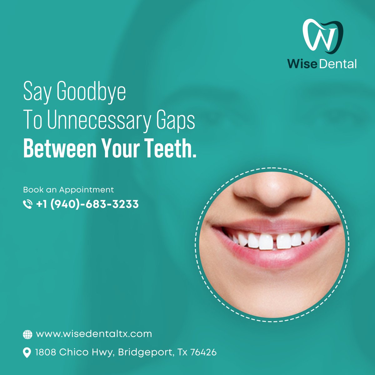 wise_dental's tweet image. Unnecessary gaps between your teeth don't only contribute to your face's appearance but also make way for potential dental issues. 

Call: 940-683-3233
Visit: wisedentaltx.com

#WiseDental #Toothgap #DentalBraces #braces #dentistry #oralhealth #Bridgeport #Texas #USA