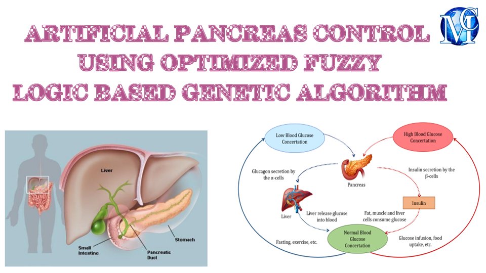 medcraveonline's tweet image. Artificial pancreas control using optimized fuzzy #logicbased #genetic #algorithm, published in International #Robotics & #AutomationJournal by Ahmed J Abougarair, et al.
For more info please visit link below:
medcraveonline.com/IRATJ/IRATJ-09…
#insulin #patient #genetictesting #bloodsugar