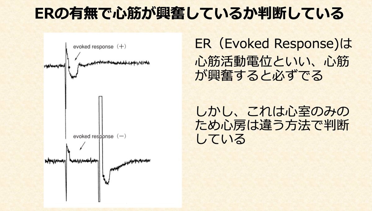 mossunsun8127's tweet photo. 自動閾値測定方法をまとめました。
AVCとACR法を組み合わせて、ペースメーカは心房興奮を判断している感じですね！！
（いいね・RTすると泣いて喜びます）
＃デバイスワンポイント知識 https://t.co/wibN5D4bKd