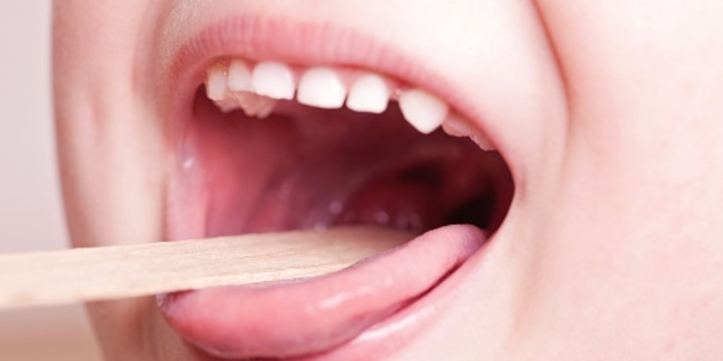AboutKidsHealth's tweet image. The tonsils help fight germs that cause infection and prevent you from getting sick. When tonsils are doing their job fighting viruses and bacteria, they become inflamed and red and can feel painful. Learn more: ow.ly/mjXL50PkZAt #Tonsillitis #SoreThroat