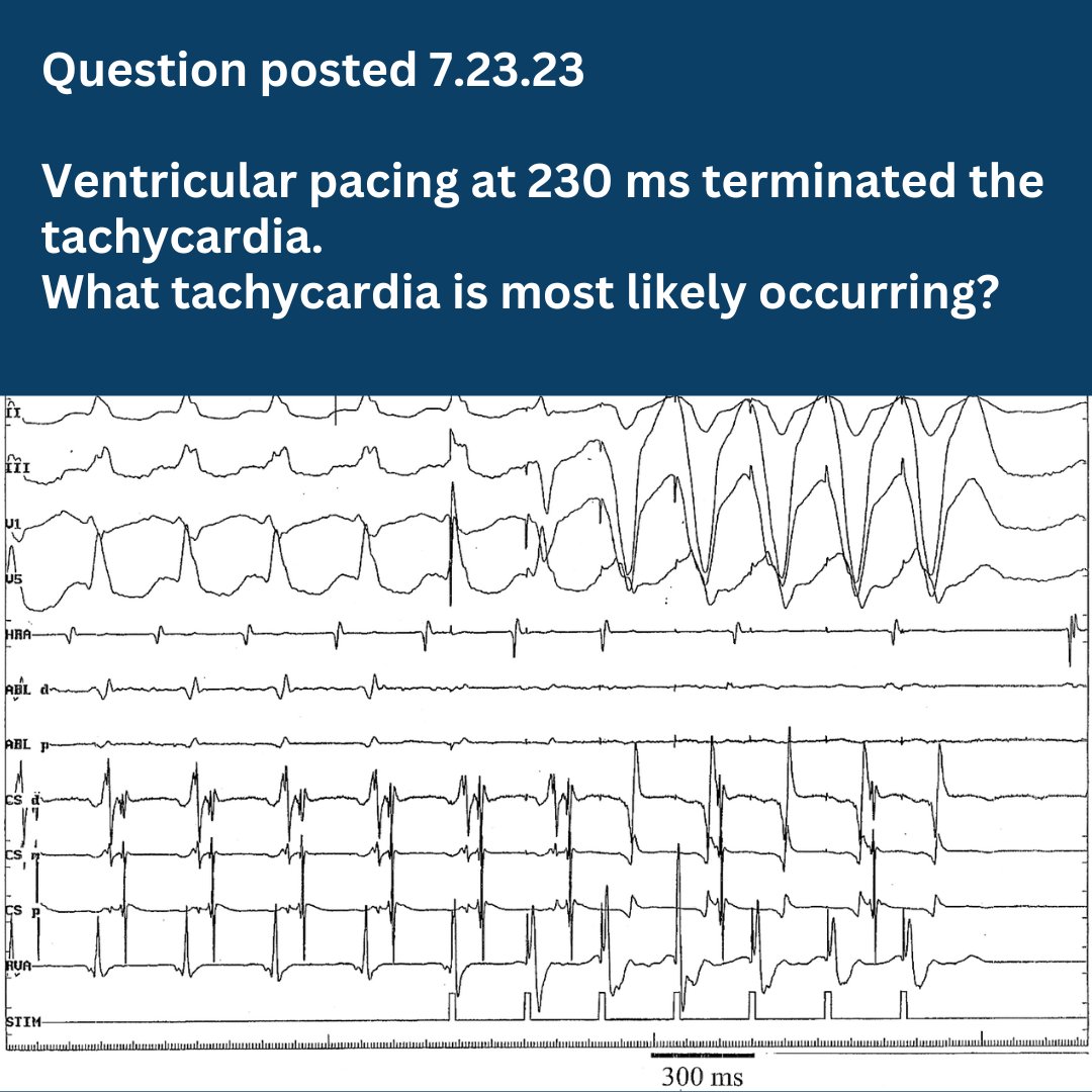 ChartAcademy's tweet photo. #Answers
📚 Need a full course on EGMs? #EPnerd
🤓 Come to the CHART Course Store 👇 👇 👇
https://t.co/ERa4ifEkE1
🎓 Coach recommendation:
Electrogram Essentials: The Long and Short of EGMs
10% off?
Code: Welcome10
#EPeeps #VivaEP #EGMReview #Electrophysiology #RCES #CEPS https://t.co/zOxqhwmOsm