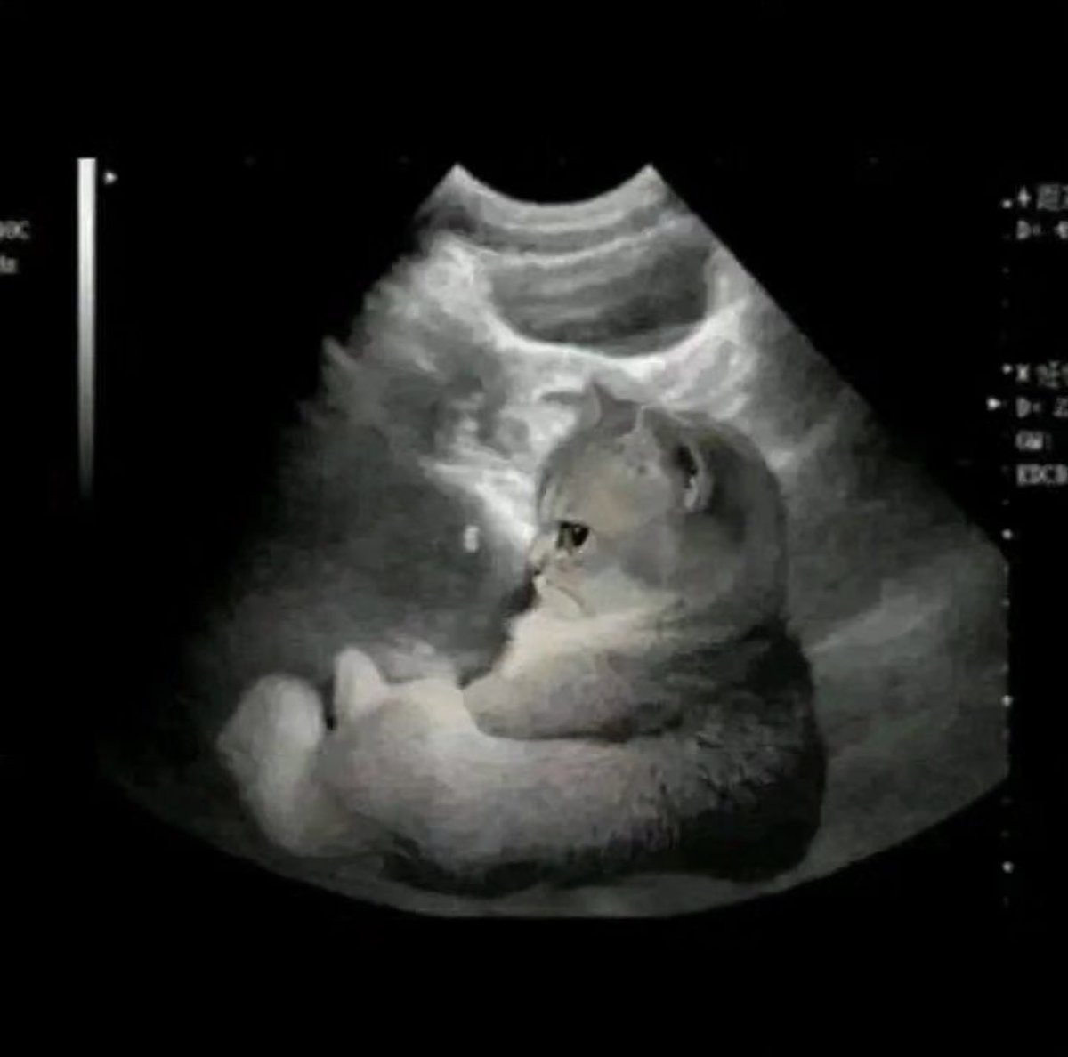 positive side of X 🌞 tweet media