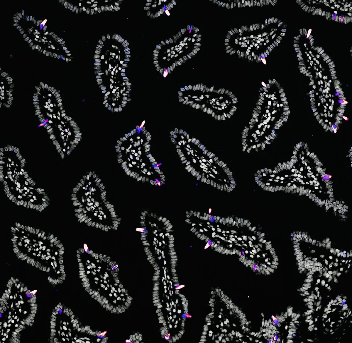 Tuft cells looking a little comet-esque ☄️ in the small intestine