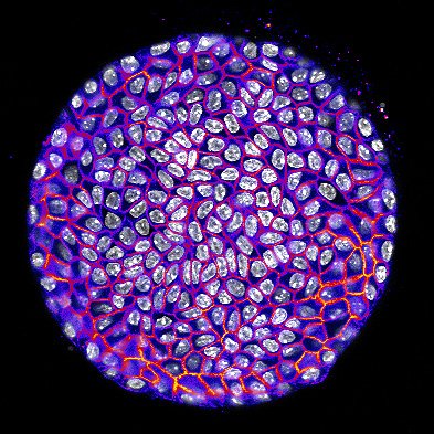 Liver #organoids might be my favorite organoids