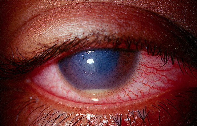 Review of Optometry tweet media