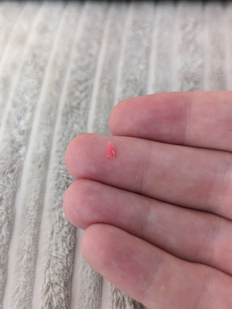 Ryan_P_Moss's tweet photo. Hey @AldiUK Think your chicken steaks should come with a health warning. A really sharp piece of red plastic embedded inside the chicken. Purchased from your Chichester store. Wtf. Glad I spotted it. https://t.co/9xY842bgKt