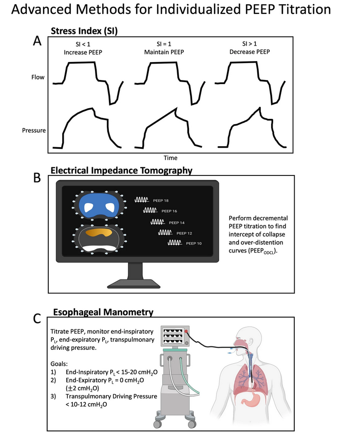 Management of severe acute respiratory distress syndrome: a primer

CCR Journal Watch
criticalcarereviews.com/latest-evidenc…

Get the latest critical care literature every weekend via the CCR Newsletter - subscribe at criticalcarereviews.com/newsletters/su…