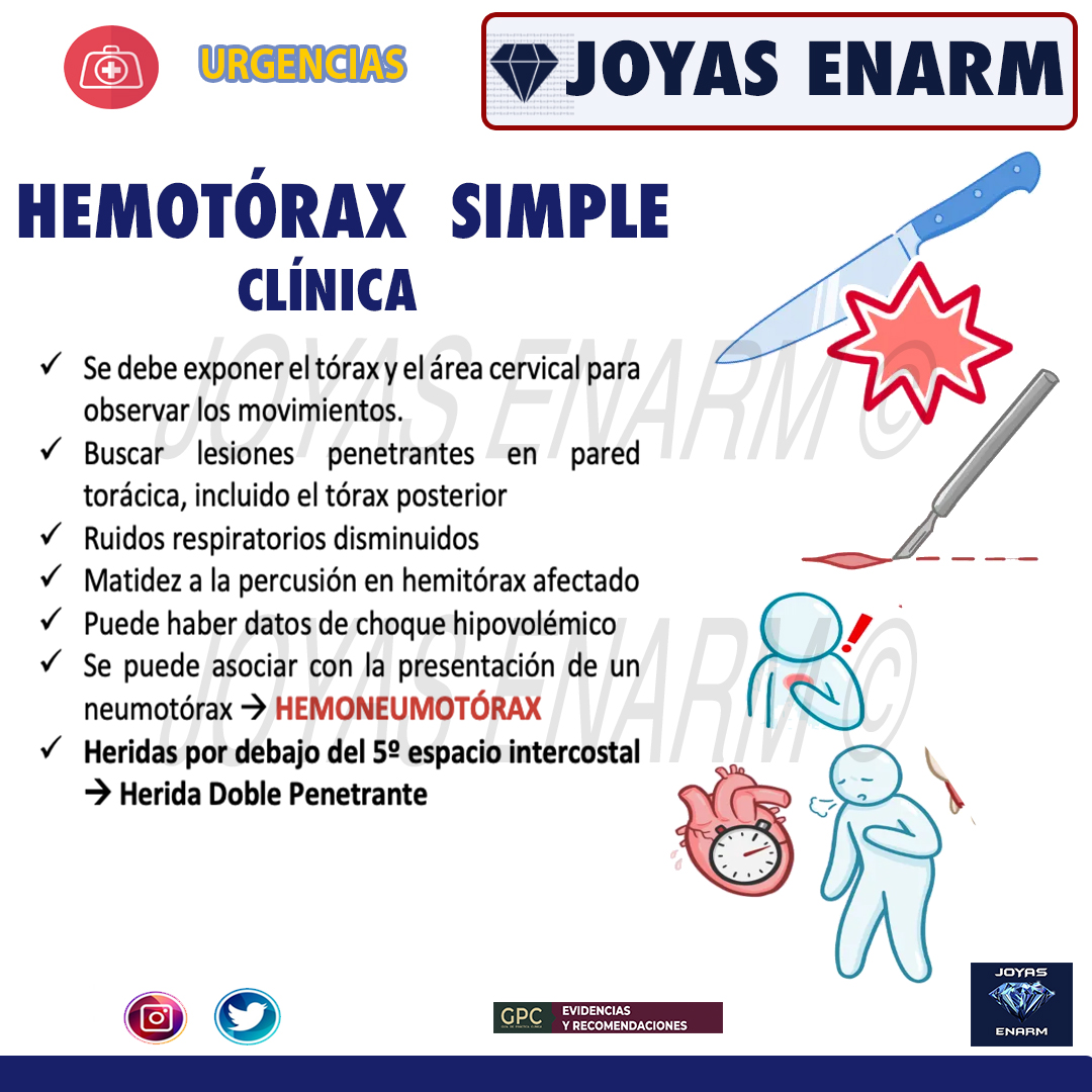 Joyas_ENARM's tweet photo. REPASO  HEMOTÓRAX:

💎 https://t.co/O0EgHOujZP 💎
#ENARM #ENARM2023 https://t.co/GtmRF9yYfN