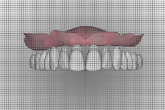 InDentalTech's tweet photo. In case you missed it! #MasterClassFlashback: “Digital Transformation of Denture Workflows” by Robert Kreyer, CDT https://t.co/rtY4n6hDVK https://t.co/0bV0wd3637