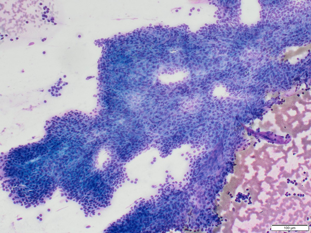 Philippe Stephenson, MD tweet media