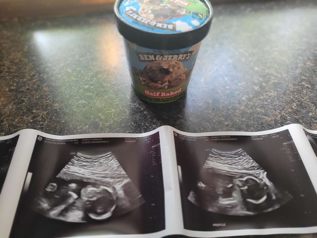 myranduhplease's tweet photo. Halfway there with our sweet boy! 😭❤️ https://t.co/b723M8oRA2