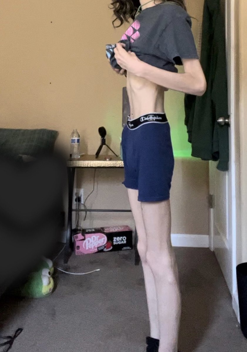 decomposedmoon's tweet photo. 4 month difference
march 17, 2023 (95lbs | 43kg) vs july 19, 2023 (74lbs | 34kg) https://t.co/s6g9BSBpL4