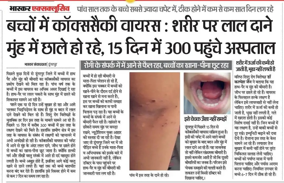 siddarthps's tweet image. बच्चों में हाथ पैर मुँह की बीमारी, चेचक समझने की गलती नही करें... करे...#Dungarpur #RajasthanNews @Ajay_Rawat20 @DainikBhaskar @RajCMO