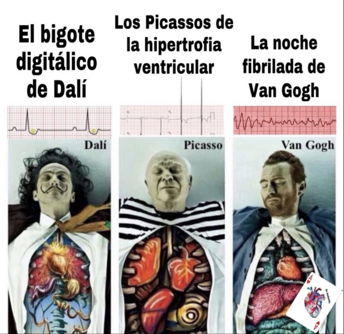 Arte y EKG…🥰🫀⚡️