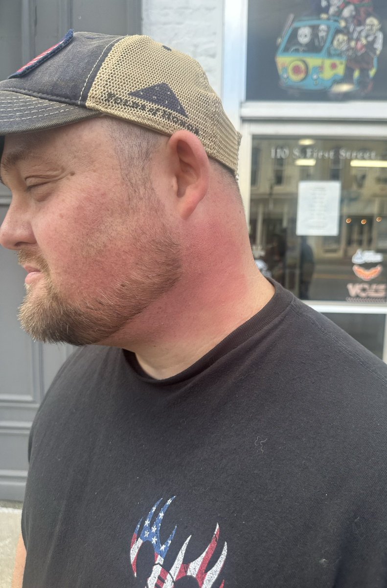 KayfabeCave's tweet image. Took the Dr. D slap like a man. This was awesome! I'm proud of this moment! Dr. D didn't hold back. HELL YES!!! @HeyHeyItsConrad @DarkSideOfRing  @TheJimCornette @livewolfied 
#slap #DavidSchultz #wrestling #Kayfabe #darksideofthering #NotFake #AEWDynamite #WWE