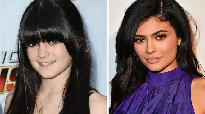 RT @ThePopTingz: Kylie Jenner confirms again:

“I have never had plastic surgery in my life.” https://t.co/dg4yW9wuw3