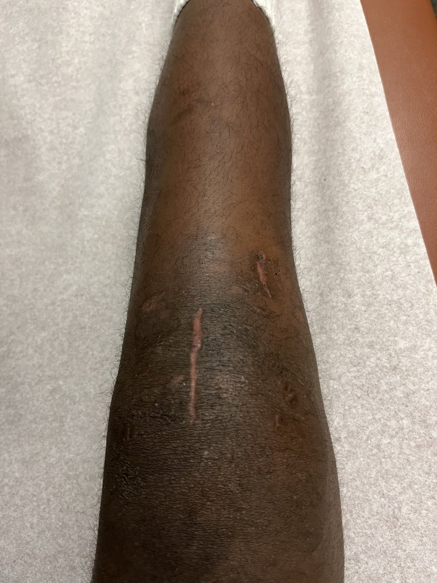 Simon Habte tweet media