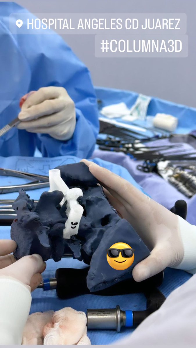 OrtoDrJuarez's tweet photo. Columna y guías paciente-especificas para tornillos transpediculares #orthotwitter #3dcot #3dprint #spine https://t.co/3JEIN3WWo3