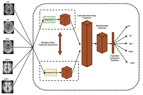 Sensors_MDPI's tweet image. #highlycitedpaper
An Intelligent System for Early Recognition of Alzheimer’s Disease Using Neuroimaging
mdpi.com/1424-8220/22/3…
#IntelligentSystem #ImageProcessing #MRI #Neuroimaging #DeepLearning