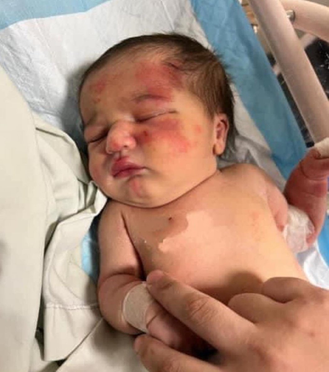 Abandoned baby in the garbage found and carried by dog. 
Another lesson #lebanon #tripoli #baby #abandoned #saved #dog #garbage #hope #life