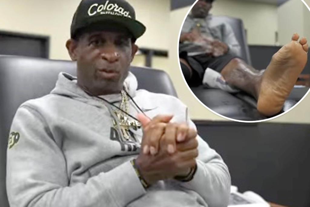 Deion Sanders Bladder Cancer