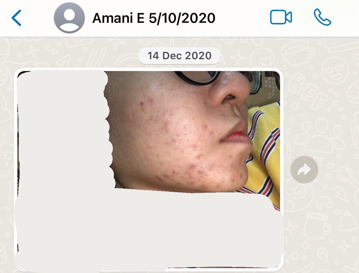Pastel_HQ's tweet photo. Betul la orang cakap, consistency is the key 💫

Dari zaman breakout, maskne, tiny bumps sampai flawless! 🥺🦋 https://t.co/Df2MoLCfbV
