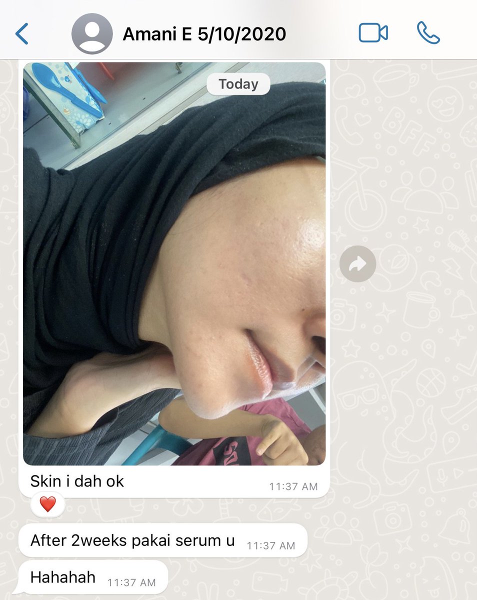 Pastel_HQ's tweet photo. Betul la orang cakap, consistency is the key 💫

Dari zaman breakout, maskne, tiny bumps sampai flawless! 🥺🦋 https://t.co/Df2MoLCfbV