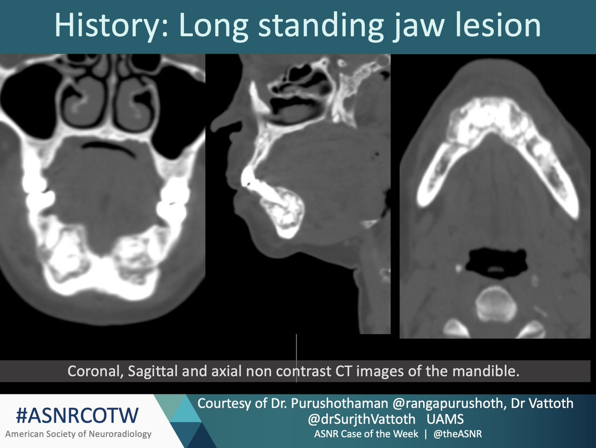 The American Society of Neuroradiology tweet media