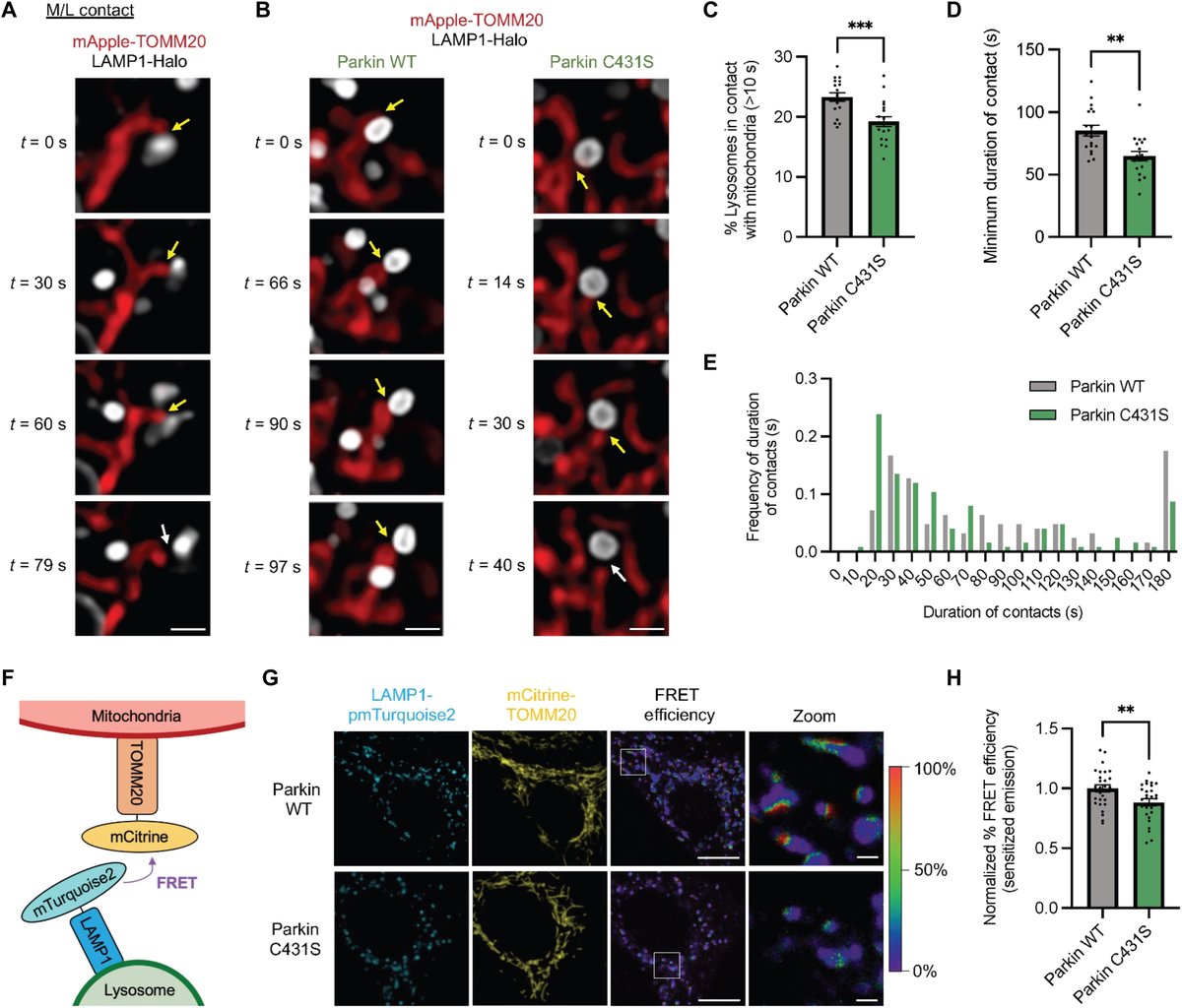 New paper from <a href="/DimitriKrainc/">Dimitri Krainc</a> &amp; <a href="/NUFeinbergMed/">Northwestern Feinberg School of Medicine</a> colleagues reports neurons carrying PARKIN variants exhibit decreased mitochondria-lysosome contacts via destabilization of Rab7; This = amino acid accumulation in lysosomes &amp; their deficiency in mitochondria
science.org/doi/10.1126/sc…
