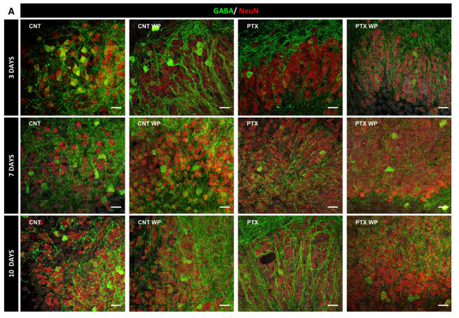 apoyodravet's tweet photo. El grupo de investigación @Indrenetwork en @biocrucesHRI  publica claves sobre #neuroinflamanción y #epilepsia para la prevención. 

Red científica liderada por ApoyoDravet y coordinada por @luismiaras.
#cienciaAD 

Más información y acceso al artículo

https://t.co/Tjste8uMlT https://t.co/l5kxkDJBIY