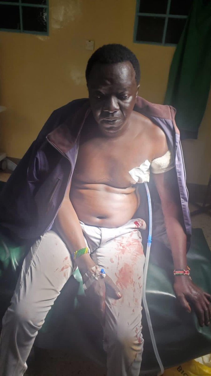 C_NyaKundiH's tweet photo. Earlier today, Dr. Ken Omondi, a medic, was shot in the arm by an undercover officer in Migori town while on his way to work. He is currently receiving medical treatment for his injuries at the county referral hospital. https://t.co/FstPUPL3Di