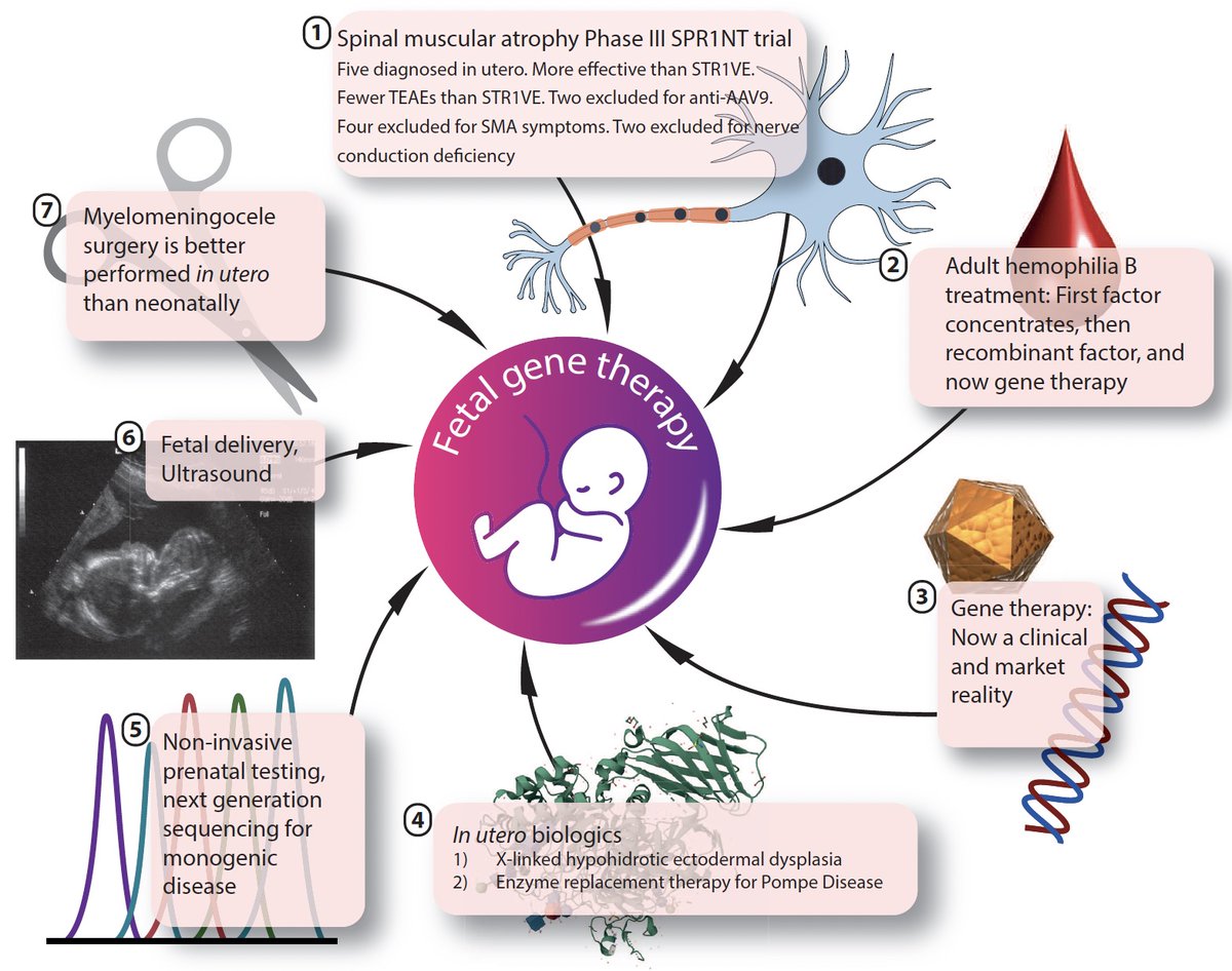 Simon Waddington (@profsimonwad) on Twitter photo Yay! Review now out in <a href="/JIMD_Editors/">The Journal of Inherited Metabolic Disease</a> "Fetal gene therapy"
<a href="/ProfAhadRahim/">Ahad Rahim</a> <a href="/PrenatalTherapy/">Anna David</a> <a href="/WPeranteau/">William Peranteau</a> <a href="/DrAKBoyle/">Ashley Boyle</a>
Hoping the final open access version doesn't have a rasterised pixellated figure😔.
<a href="/Dr_RKarda/">Raj Karda</a> <a href="/alanlparker/">Alan Parker</a> <a href="/RJYanezMunoz/">Rafael J. Yáñez-Muñoz</a> <a href="/DrJo_Ng/">Joanne Ng 伍仲昕</a> <a href="/drelliechilcott/">Ellie Chilcott</a> Yay! Review now out in <a href="/JIMD_Editors/">The Journal of Inherited Metabolic Disease</a> "Fetal gene therapy"
<a href="/ProfAhadRahim/">Ahad Rahim</a> <a href="/PrenatalTherapy/">Anna David</a> <a href="/WPeranteau/">William Peranteau</a> <a href="/DrAKBoyle/">Ashley Boyle</a>
Hoping the final open access version doesn't have a rasterised pixellated figure😔.
<a href="/Dr_RKarda/">Raj Karda</a> <a href="/alanlparker/">Alan Parker</a> <a href="/RJYanezMunoz/">Rafael J. Yáñez-Muñoz</a> <a href="/DrJo_Ng/">Joanne Ng 伍仲昕</a> <a href="/drelliechilcott/">Ellie Chilcott</a>