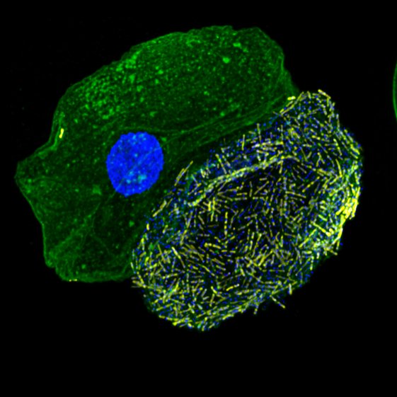 Live UTI Free (@liveutifree) on Twitter photo What do bladder biofilms look like? Find out in our new interview with Dr. Harry Horsley <a href="/BIIG_UCL/">Bladder Infection and Immunity Group</a>. Thanks for sharing your fascinating work with our community! youtube.com/watch?v=pq1K1z… What do bladder biofilms look like? Find out in our new interview with Dr. Harry Horsley <a href="/BIIG_UCL/">Bladder Infection and Immunity Group</a>. Thanks for sharing your fascinating work with our community! youtube.com/watch?v=pq1K1z…
