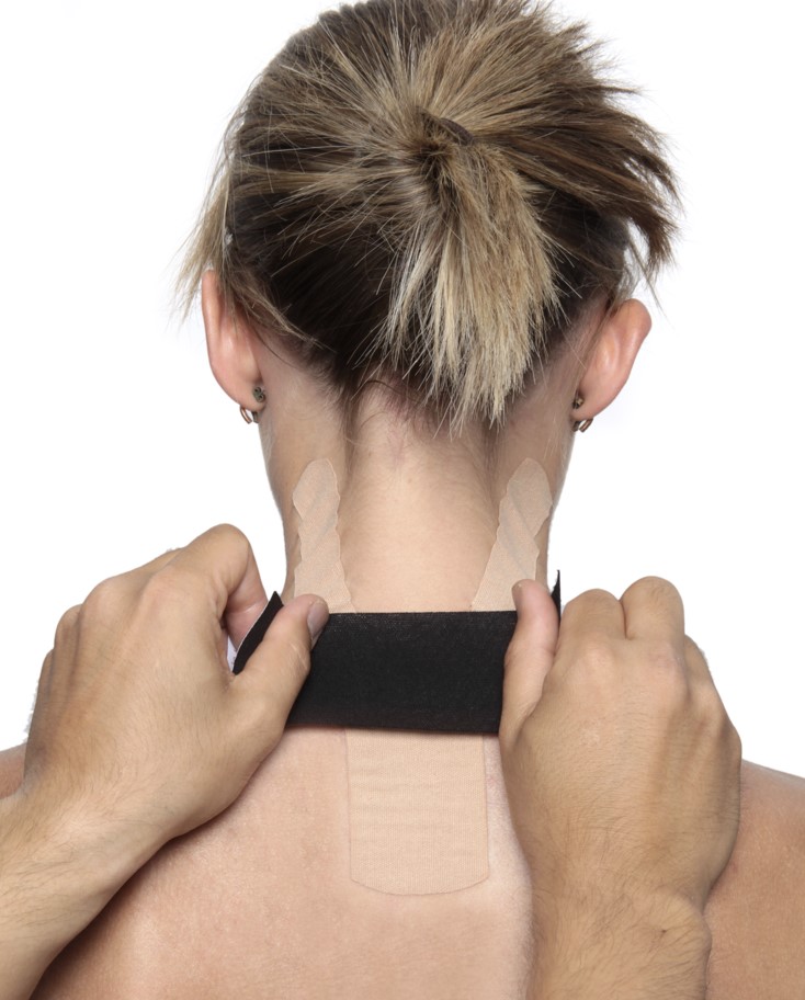 Kinesio_UK's tweet photo. There are a number of issues that cause pain directly in the neck, but irritation along the nerve pathways can also cause pain into the shoulders, arms and hand. This taping application, using the #Kinesiotaping Pre-cut Neck pack, can be useful for muscle support. https://t.co/UoLNgugWOm
