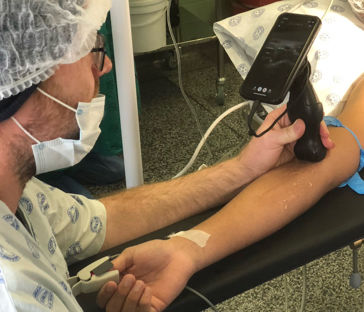 James Porter (@drjamesporter) on Twitter photo Had fun with my new <a href="/Oculine1/">OcuLine | Handheld Ultrasound Mount</a> mount to go with my <a href="/ButterflyNetInc/">Butterfly Network</a>. Makes vascular access much easier. Thanks for hooking me up <a href="/zebra_medical/">ZEBRAMEDICAL</a> Had fun with my new <a href="/Oculine1/">OcuLine | Handheld Ultrasound Mount</a> mount to go with my <a href="/ButterflyNetInc/">Butterfly Network</a>. Makes vascular access much easier. Thanks for hooking me up <a href="/zebra_medical/">ZEBRAMEDICAL</a>