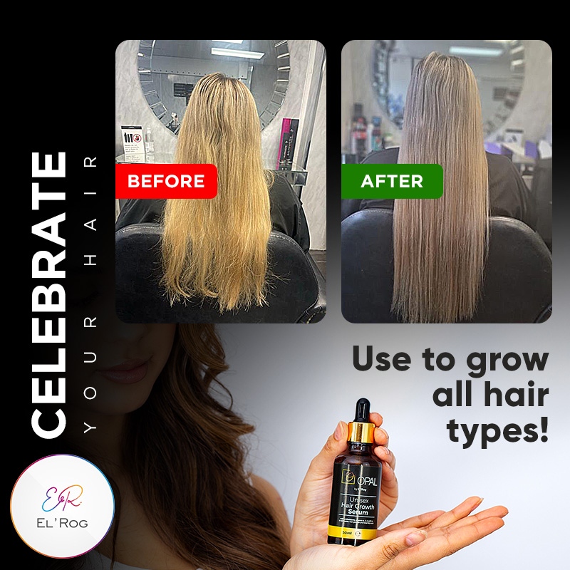 Elsie Rogers created this gem product Opal by El’Rog to treat hair loss and grow all hair types. It's your turn to experience the transformative power yourself.

🛒10% discount* code: OPAL2023

✅ *Discount for first time buyers. Ends July 31, 2023

Numonday