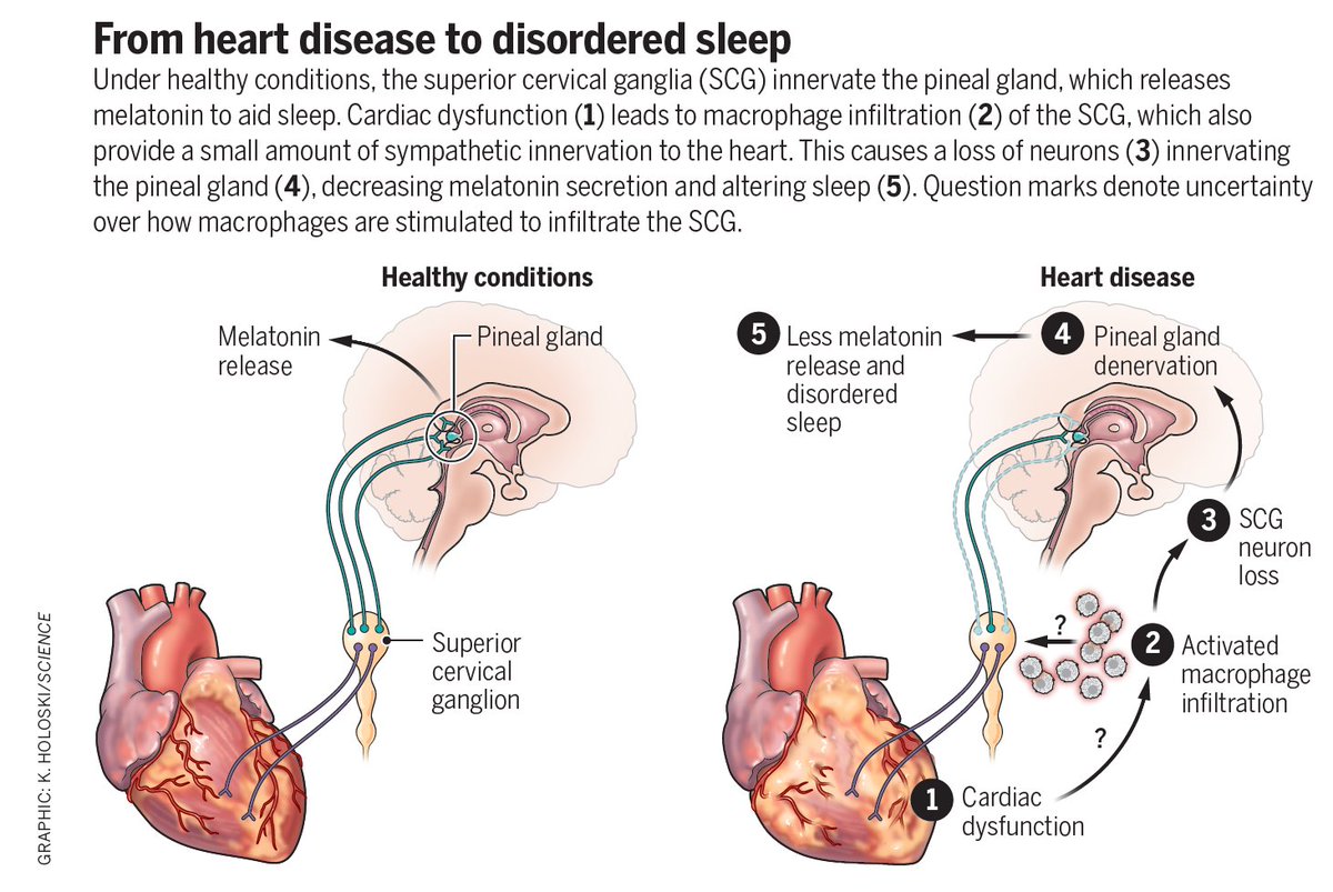 🆕@ScienceMagazine Cool science and important discovery for why people with heart failure have a sleep disorder: Immune-mediated loss of pineal gland innervation science.org/doi/10.1126/sc… science.org/doi/10.1126/sc… @ScienceVisuals