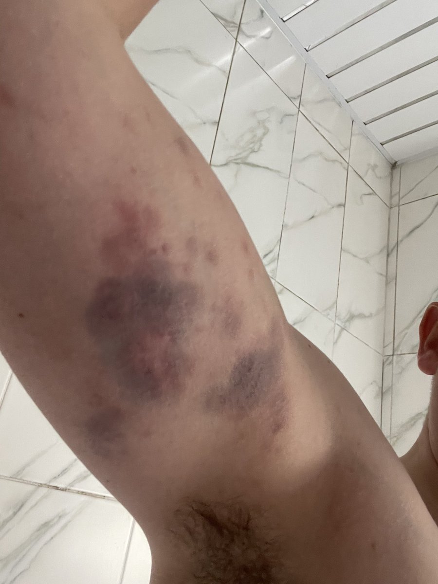 leembroad's tweet photo. Had officer safety training refresher today and finally  @gmpolice have got it right.  Was the most relevant OST I’ve had in 16yrs. A full day of scenarioS covering searches, cell entry, knife attacks, ABD, non compliant/violent individuals…not sure my body agrees though #aching https://t.co/llh13DZsaj