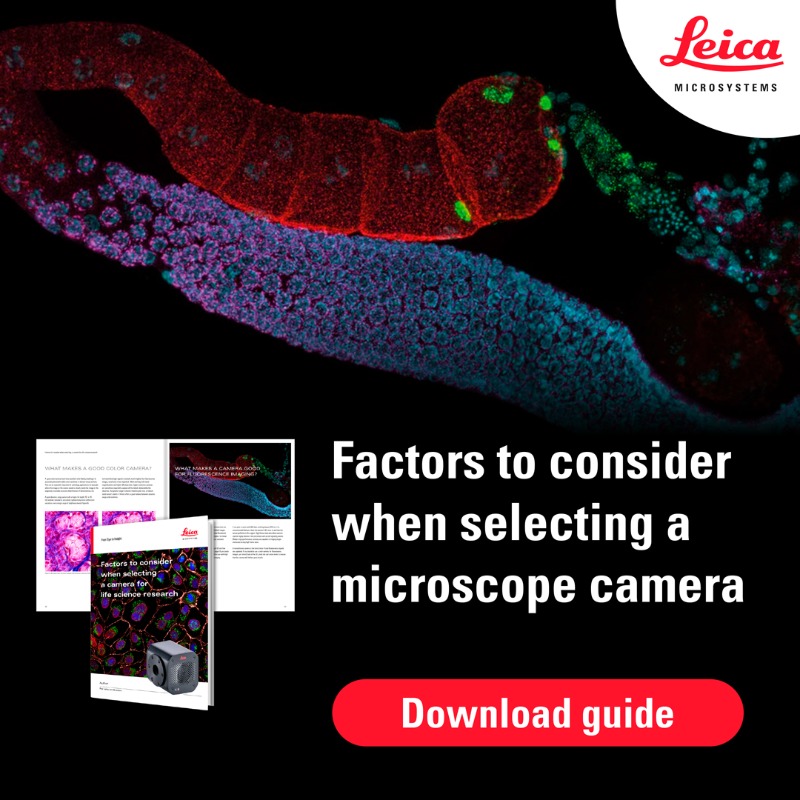LeicaMicro's tweet photo. ☑️ How do you choose the right #microscope camera for your life science research? 

☑️ What makes a camera good for #fluorescenceimaging or brightfield imaging, or both? 

☑️ Find out the answers to these, and similar questions, in this new guide. Download guide!