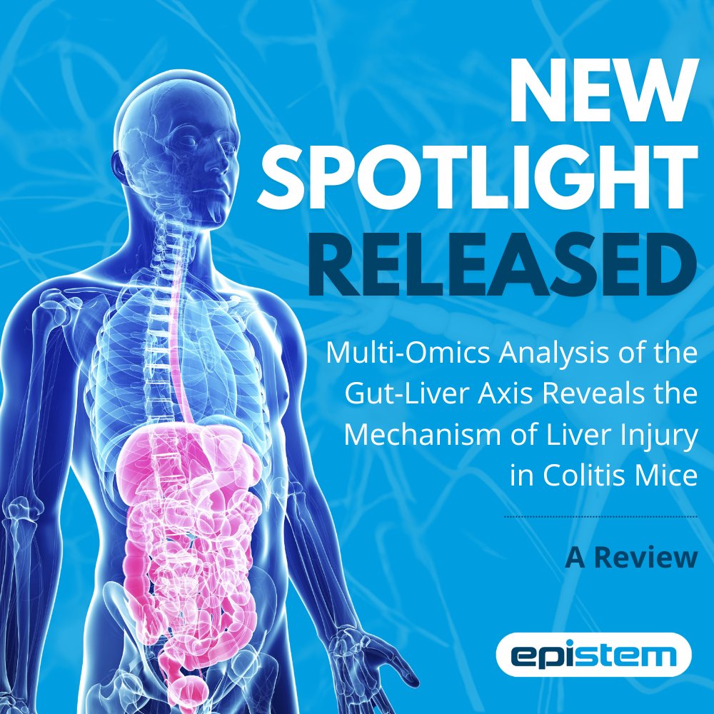 Check out our latest Spotlight 💡

epistem.co.uk/spotlights/ibd…

#CRO #DrugDiscovery #ContractResearch #Pharmacogenomics #DNASequencing #Epistem