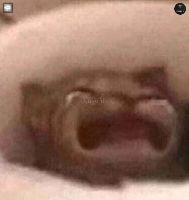 BaseAnakFK's tweet image. Dok bntar lagi osce ini anamnesis sama PF anak serius selesaikah dalam waktu sepuluh menit atau biasanya dipisah ya sama pfnya ini nyoba sepuluh menit dari semalem gk bisa😭 padahal jdh kyk ngerap ngomongnya