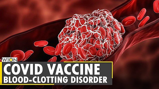 Galadriell__'s tweet photo. 🔴 Des chercheurs découvrent que la microcoagulation et le "Covid long" sont causés par les vaxxins anti #Covid19

Selon une nouvelle étude préliminaire réalisée par Harriet Carroll, chercheuse en maladies cardiovasculaires, et le Dr Robin Kerr, médecin généraliste à l'université de Lund, la coagulation sanguine sous forme de "microcoagulation" est en grande partie à l'origine du développement du "covid long", d'après https://t.co/tlJPfXSBRJ.

📍Étude : https://t.co/MSi2A7I062

Étant donné que les symptômes du covid long sont étroitement liés aux dommages causés par le "vaccin" anti Covid19, Kerr et Carroll ont suggéré que le terme "covid long" se réfère peut-être aux personnes qui ont reçu un vaccin anti-covid et qui souffrent actuellement de microcoagulation.

📍https://t.co/Ga6UimWlwJ

Selon Etheresia Pretorius, professeur et chercheur renommé de l'université de Stellenbosch qui se consacre à l'étude de la microcoagulation, s'il ne s'agit pas de la seule pathologie chez les patients atteints de covidi long, c'est sans aucun doute l'une des plus courantes.

Des caillots commencent à se former dans les vaisseaux sanguins lorsque le contenu d'un flacon de vaccin anti-covidien est injecté et distribué dans le corps d'une personne, empêchant l'échange de nutriments. En conséquence, les cellules adjacentes sont privées d'oxygène et fonctionnent mal, ce qui peut entraîner de la fatigue, un essoufflement, un "brouillard cérébral" et même une neuropathie en général. "Certaines protéines impliquées dans la microcoagulation jouent également un rôle dans l'activation des voies auto-immunes et des mastocytes", explique le rapport. "La microcogulation est donc associée à des conditions telles que l'auto-immunité et le syndrome d'activation des mastocytes, caractérisé par des symptômes allergiques tels que l'urticaire, le gonflement et l'essoufflement."

Les thérapies qui aident à rétablir la circulation semblent être parmi les plus efficaces pour traiter les symptômes du covid long et de la microcoagulation, car les protéines de pointe dans les vaccins anti Covid provoquent la production de caillots plus gros que la normale sans thrombine et sans plaquettes. Le Dr Angela Bowers, dermatologue, affirme que la plupart de ses patients souffrant de maladies chroniques sont grandement soulagés par ces traitements.

La Frontline COVID-19 Critical Care Alliance (FLCCC) a publié une série de documents expliquant la pathologie de la coagulation sanguine et certaines des procédures thérapeutiques utilisées par cette organisation pour rétablir la circulation chez les patients. Selon les experts de la FLCCC, les protéines de pointe contenues dans le vaccin en sont en grande partie la cause. "Les protéines spike se trouvent à la surface du virus COVID-19, qui les utilise pour envahir les cellules et les endommager. De même, les vaccins ARNm ordonnent à l'organisme de produire des protéines spike", explique le même rapport mentionné ci-dessus.

Les protéines spike sont connues pour provoquer la formation de caillots sanguins. Cela expliquerait pourquoi certains des caillots prélevés ne semblent pas être du sang, mais plutôt une substance collante, de couleur plus claire, qui obstrue les artères.

"Les protéines Spike affectent la paroi interne des vaisseaux sanguins en se liant aux récepteurs ACE-2 des cellules endothéliales. L'ACE-2 a été identifié comme le principal récepteur utilisé par le virus SARS-CoV-2 pour pénétrer dans les cellules, et les cellules endothéliales sont abondantes au niveau des récepteurs ACE-2, ce qui les rend particulièrement vulnérables à l'infection. Par conséquent, les protéines de pointe peuvent pénétrer dans les cellules endothéliales et activer les voies inflammatoires, ce qui conduit finalement à la formation de caillots sanguins".

La formation de caillots qui obstruent le système cardiovasculaire est déclenchée par les protéines spike, qui provoquent également une hyperactivation des plaquettes 🔽