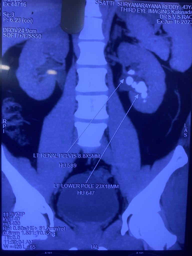 Dr Chandra Mohan Vaddi tweet media